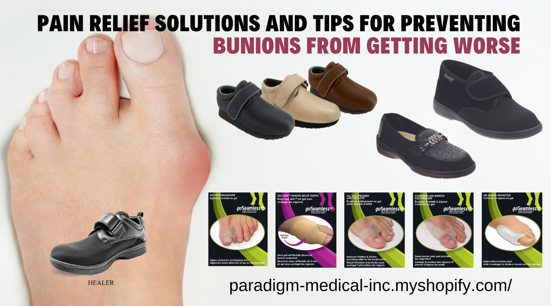 Tips on Preventing Bunions from Worsening