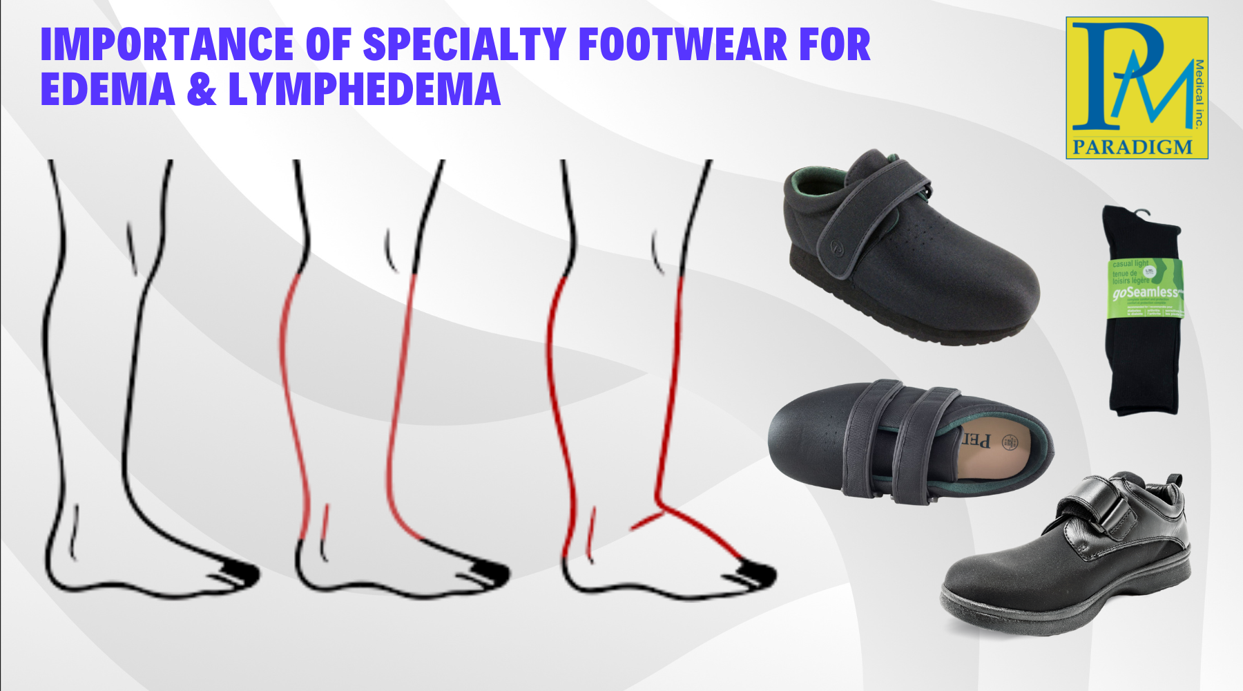 The IMPORTANCE OF SPECIALTY FOOTWEAR for Lower Extremity Edema and Lymphedema!