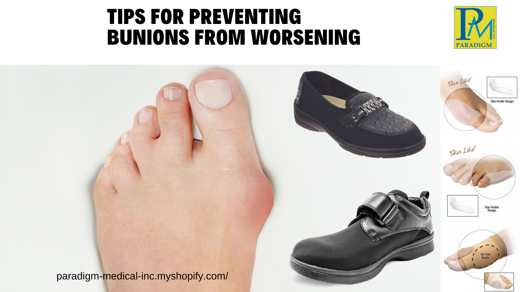Tips on Preventing Bunions from Worsening