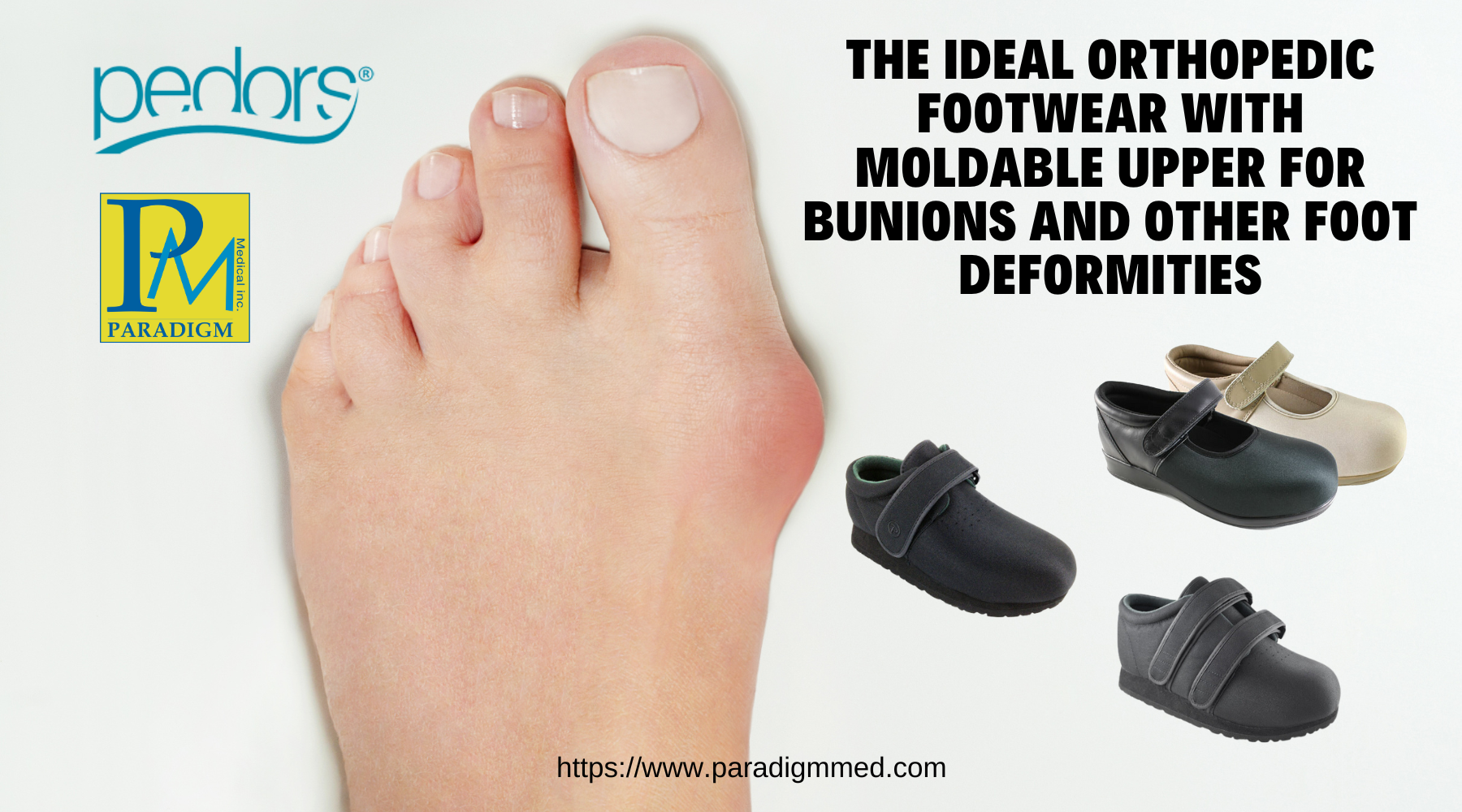 Heat Moldable Shoes for Bunions and Other Foot Deformities