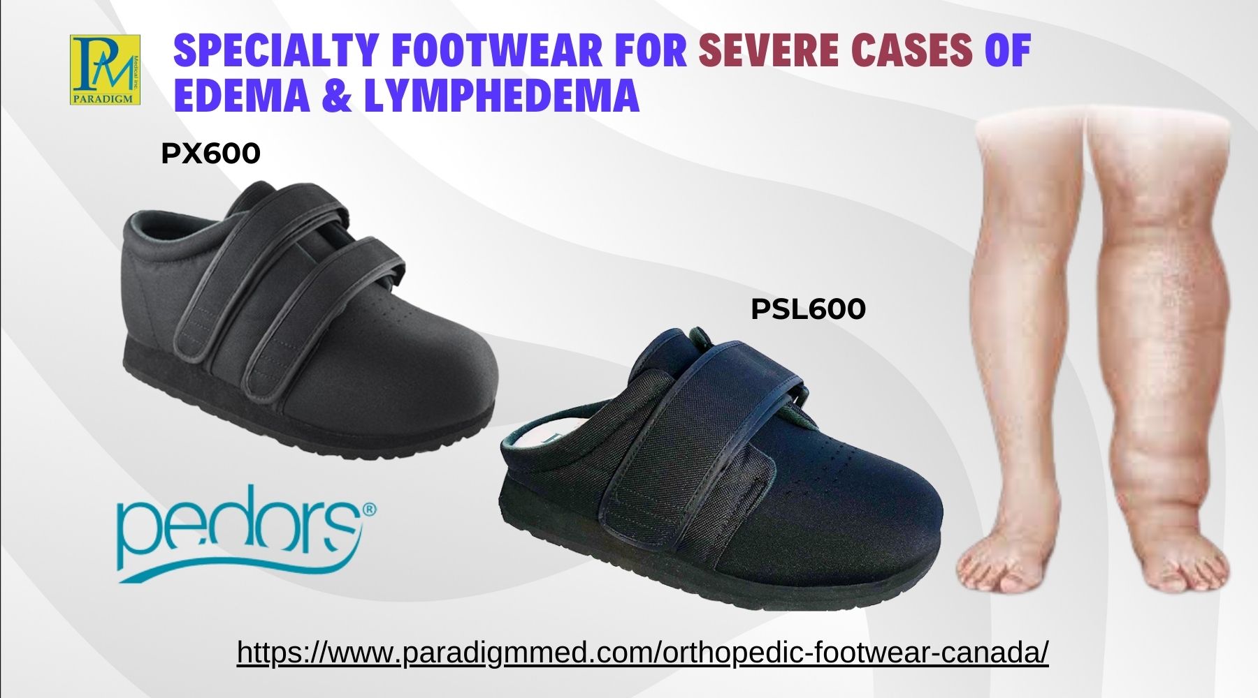Footwear Solutions for Patients with Extreme Cases of Edema and Lymphedema