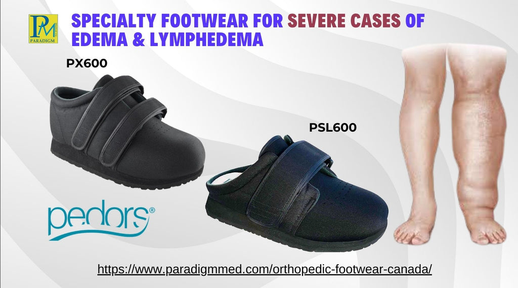 Footwear Solutions for Patients with Extreme Cases of Edema and Lymphe