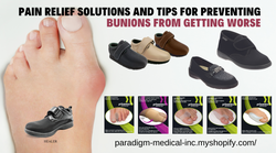 Tips and Non-Surgical Solutions to Prevent Bunions from Worsening