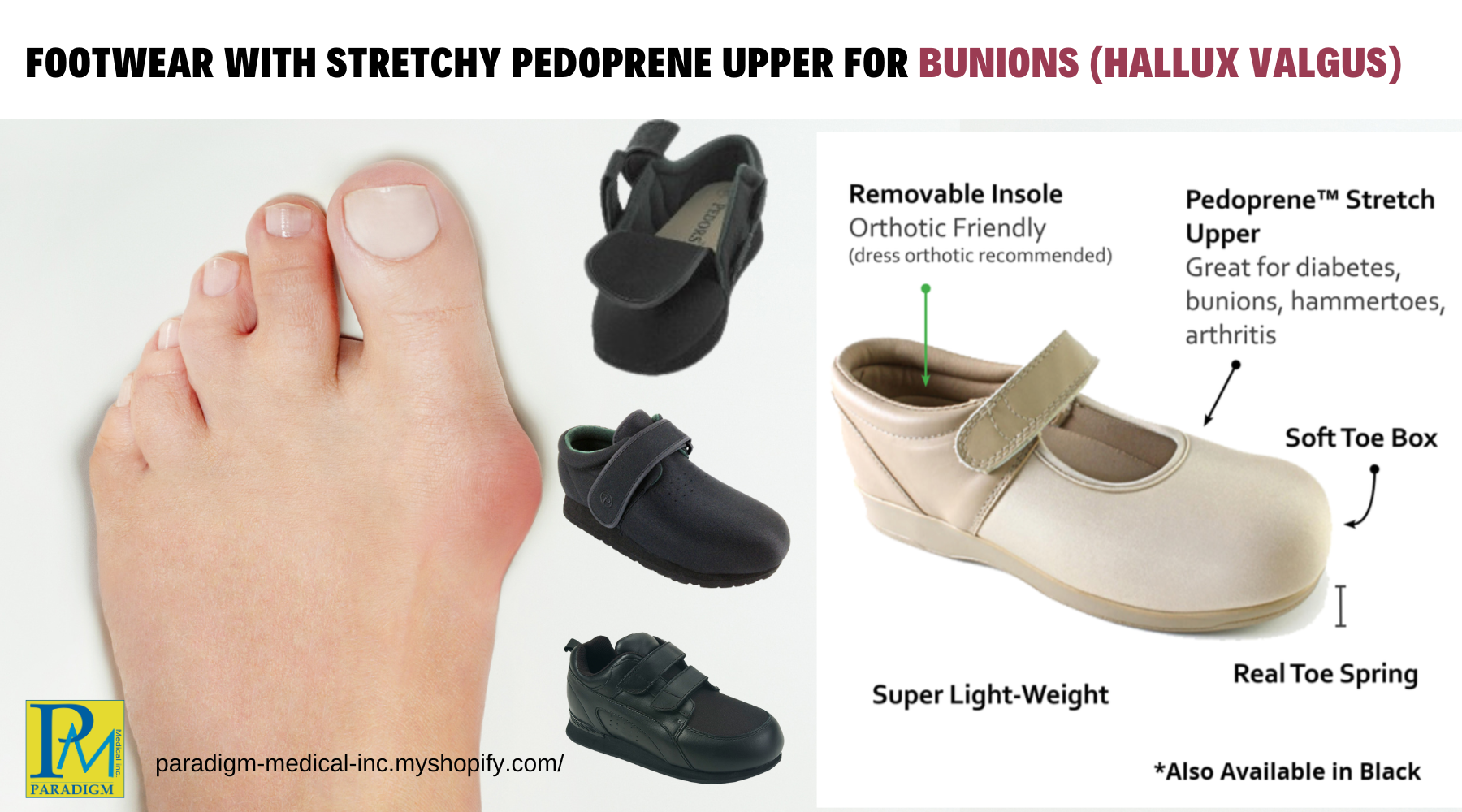 Heat Moldable Pedors Footwear for Bunions & Other Foot Deformities